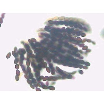 Saccharomyces cerevisae W.M. Budding Cells
