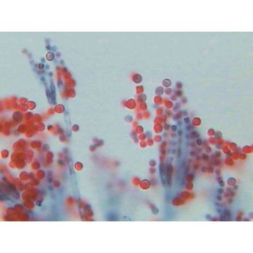 Aspergillus on Substrate with Condiospores