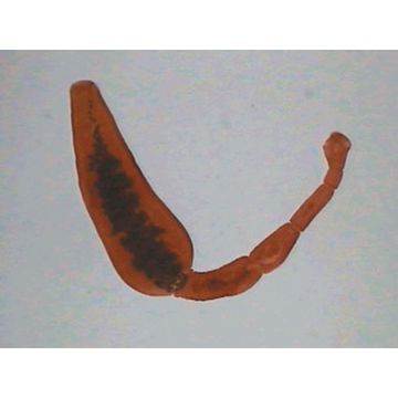 Tapeworm (Echinococcus granulosus) W.M. Complete