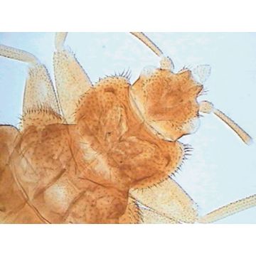 Catshark (Scyliorhinus) H.S. Gill Arch of Late Embryo