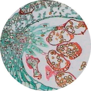 Fern (Dryopteris filix-Mas) T.S. Pinnule with Sori.