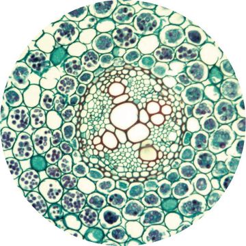 Buttercup (Ranunculus) T.S. Root Young (Protoxylem Only)