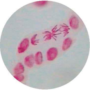 Onion (Allium) L.S. Root Tip (Stained for Mitosis All Stages)