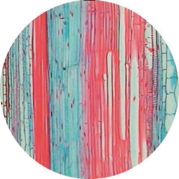 Buttercup (Ranunculus repens) T.S. Stem