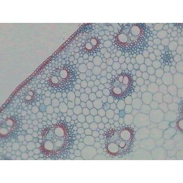 Pondweed (Potamogeton) T.S. Stem Hydrophyte