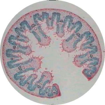 Prepared Microscope Slide - Monocot and Dicot Stem - Comparison Slide T.S.