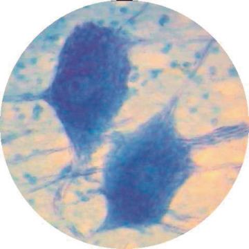 Peripheral Nerve T.S. (Plastic Embedded)