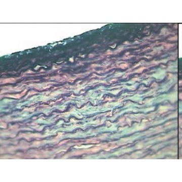 Artery and Vein Thin Sec.