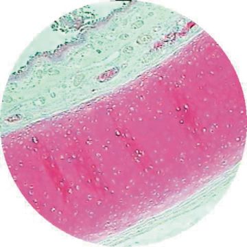 Lung T.S. Stained for Elastic and Collagen Fibres of Alveolar Walls.