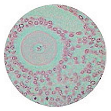 Kidney V.S. Thin Sec. (Plastic Embedded)