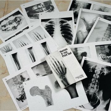 Human X-Ray Print Set - A3