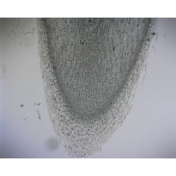 Broad Bean (Vicia) L.S. Root Tip