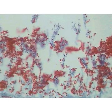 Basic Mycology Slide Set